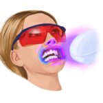 in office professional teeth whitening