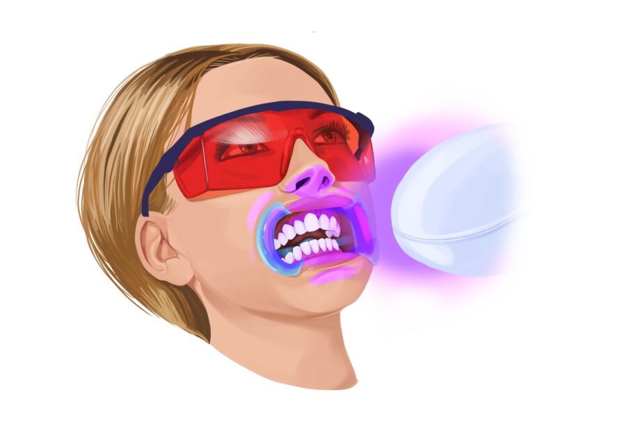 in office professional teeth whitening